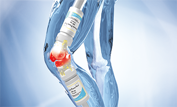 Specialistų darbo grupė rekomenduoja vartoti gliukozaminą osteoartritui gydyti Specialistų darbo grupė rekomenduoja vartoti gliukozaminą osteoartritui gydyti